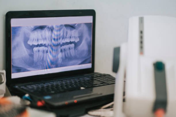 X Ray Screen On Laptop At Dental Office